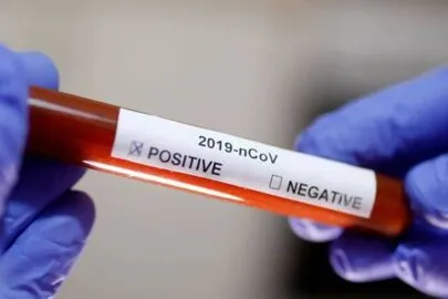 Ivaiporã tem mais 10 pacientes confirmados com covid-19