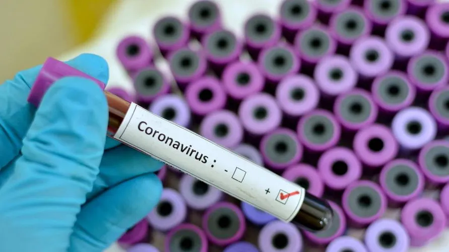 Cinco pessoas testaram positivo para Covid-19 em Jandaia do Sul