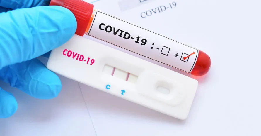 Ivaiporã contabiliza mais um caso de coronavírus