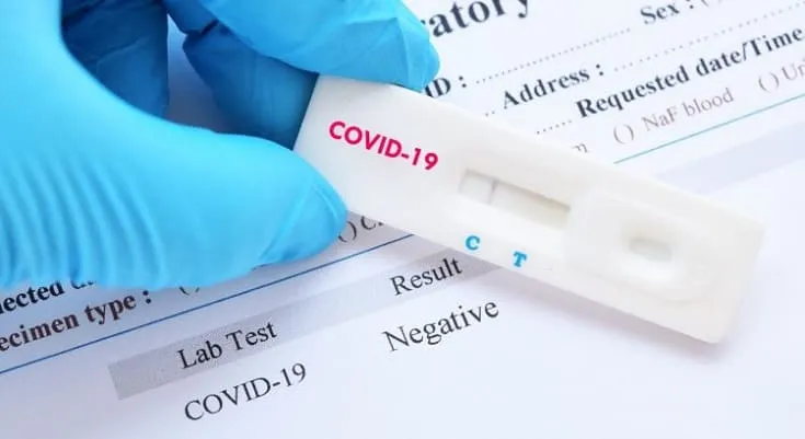 Acia fecha parceria para oferecer testes da Covid-19