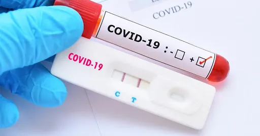 Apucarana registra 21 novos casos de Covid-19 nesta terça
