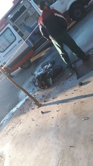 Rapaz tem corpo queimado após sua moto pegar fogo em acidente