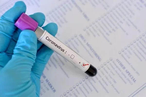 Dois novos casos de coronavírus são registrados em São Pedro do Ivaí