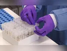 Com mais 18 diagnósticos positivos, Ivaiporã contabiliza 433 casos de Covid-19