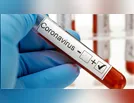 Borrazópolis eleva casos de Covid para 50 com mais um registro