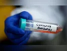 Ivaiporã contabiliza mais seis casos de coronavírus (Covid-19)