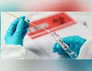 Ariranha do Ivaí tem mais um diagnóstico positivo de Covid-19