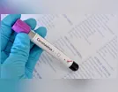PANDEMIA