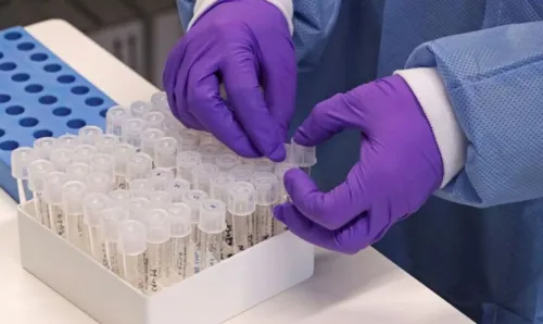 São João do Ivaí confirma mais cinco casos, e segundo óbito por Covid-19