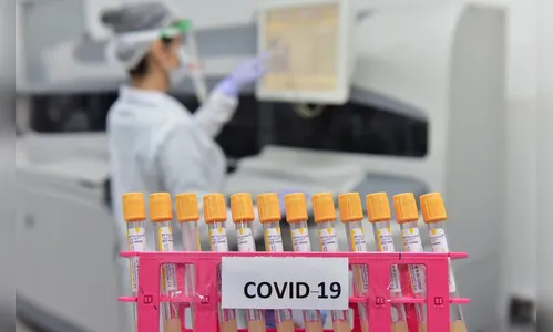 Reino Unido acusa russos de tentarem roubar informações sobre vacina contra covid