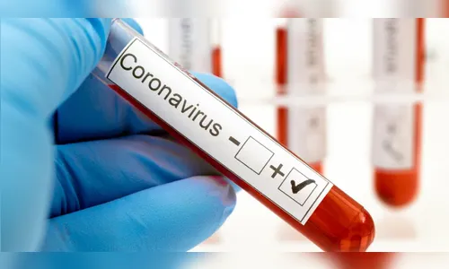 Borrazópolis confirma mais um caso de covid-19