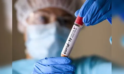 Novos casos de Covid-19 são confirmados em São Pedro do Ivaí