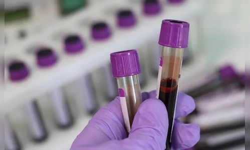 Jardim Alegre chega aos 55 casos de Covid-19