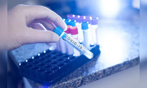 Mais oito casos do novo coronavírus são confirmados em Apucarana