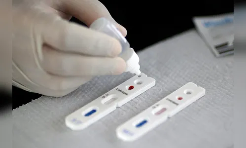 Teste rápido permite saber se a pessoa teve ou não contato com o covid-19