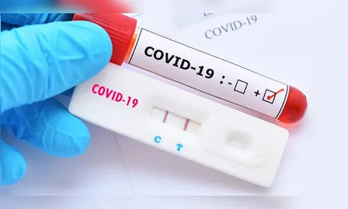 Apucarana registra 21 novos casos de Covid-19 nesta terça