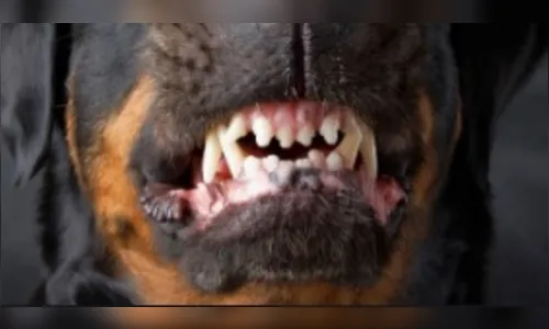 Criança tem orelha lacerada após ataque de cão em Apucarana