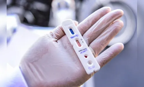 Londrina totaliza 3.951 casos positivos de Covid-19