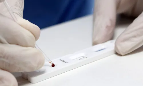 Paraná ultrapassa 100 mil casos e 2,5 mil mortos pela Covid-19