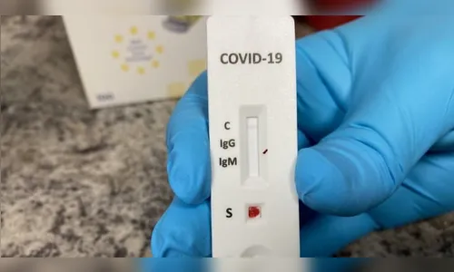 Três pessoas morrem por Covid-19 em Londrina