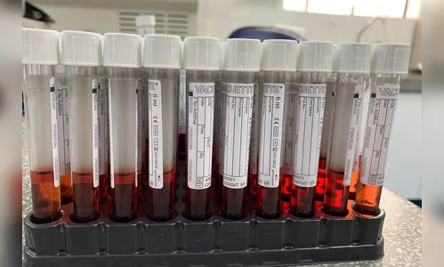 Saúde produz 100 mil tubos para transporte viral de testes de Covid-19