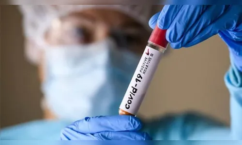 Ivaiporã confirma mais três novos casos de Covid-19