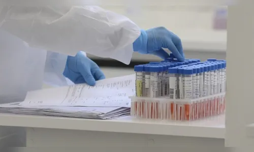 Paraná tem apenas um município sem caso algum de Covid-19