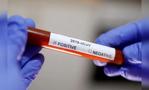 Apucarana registra 930 casos de Covid; 771 estão curados