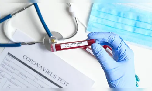 XBiotech argumenta que plasma convalescente é 'seguro e eficaz'