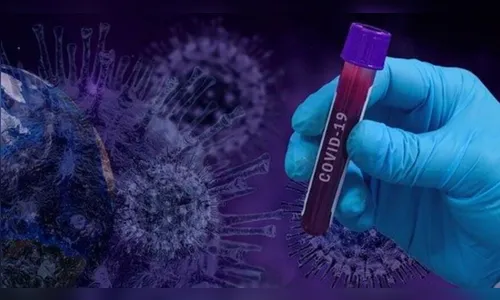 Jardim Alegre ultrapassa marca de 80  casos  de Covid-19