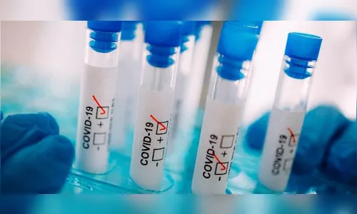 Califórnia totaliza 44 casos do novo coronavírus