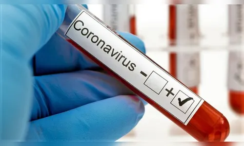 Borrazópolis eleva casos de Covid para 50 com mais um registro