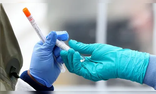 Pacientes na Bélgica e Holanda tiveram reinfecção pelo novo coronavírus