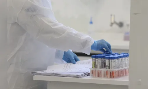 Ivaiporã passa a marca de 500 casos de Covid-19, 68% se recuperaram