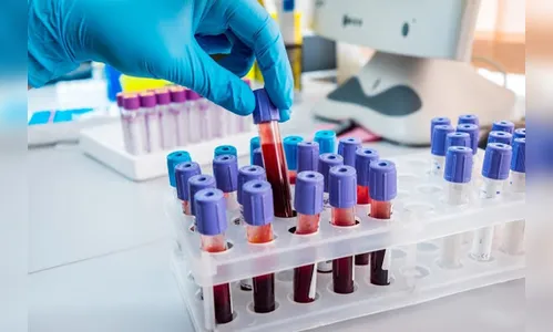 Paraná tem 122.735 confirmações e 3.114 mortes pela Covid-19