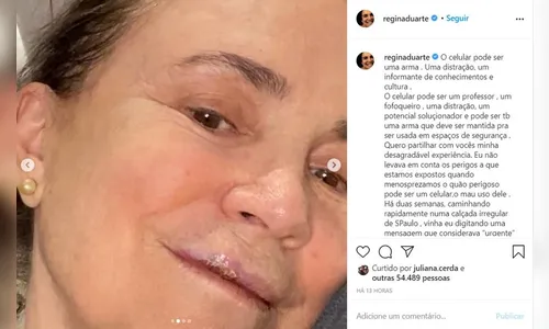 Regina Duarte cai em calçada de SP e quebra 3 dentes