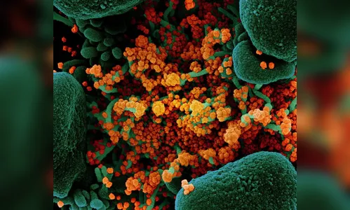 Apucarana registra mais uma morte por Covid-19