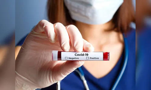 Paraná confirma 1.647 novos casos e 55 mortes decorrentes da Covid-19