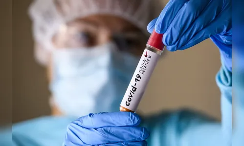 Paraná divulga 54 novos óbitos e 2.022 casos de pacientes Covid-19