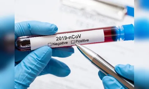 Arapongas registra 29 casos de Covid-19 e 30 curados