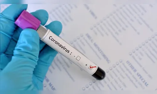Apucarana registra mais 21 casos de Covid-19