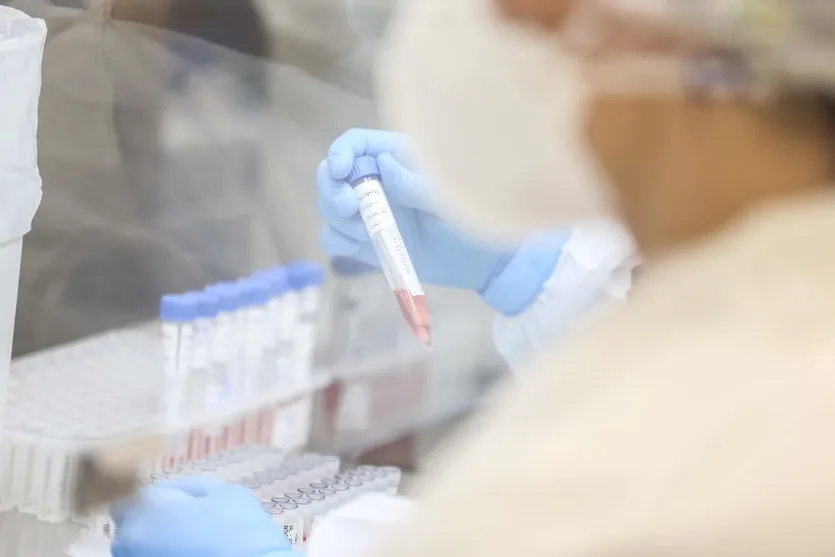 Paraná é o segundo estado que mais realiza exames RT-PCR