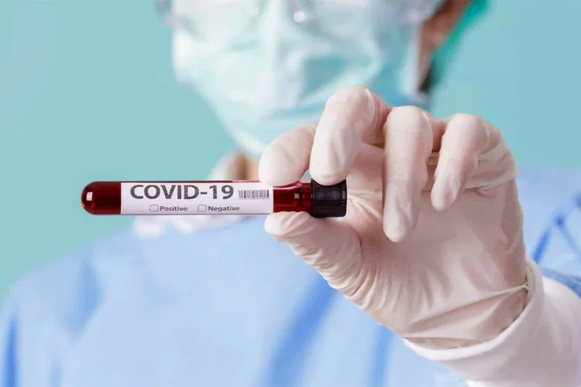 Paraná registra 1.493 novos diagnósticos de coronavírus