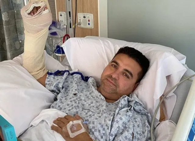 Buddy Valastro detalha acidente que causou cirurgia em sua mão