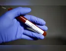 Ivaiporã confirma um caso positivo do novo coronavírus