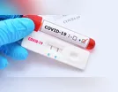 Três homens testam positivo para coronavírus em Jardim Alegre