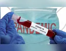 Saúde de Ivaiporã registra neste sábado (3), mais cinco novos casos de Covid-19
