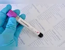 Ivaiporã registra dois novos diagnósticos positivos de Covid-19