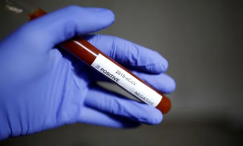 Ivaiporã confirma um caso positivo do novo coronavírus