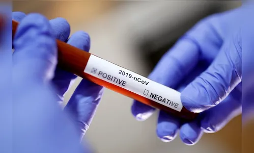 Mais dois idosos morrem por Covid-19 em Apucarana